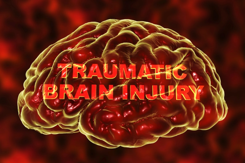 Traumatic Brain Injuries Following a Car Accident