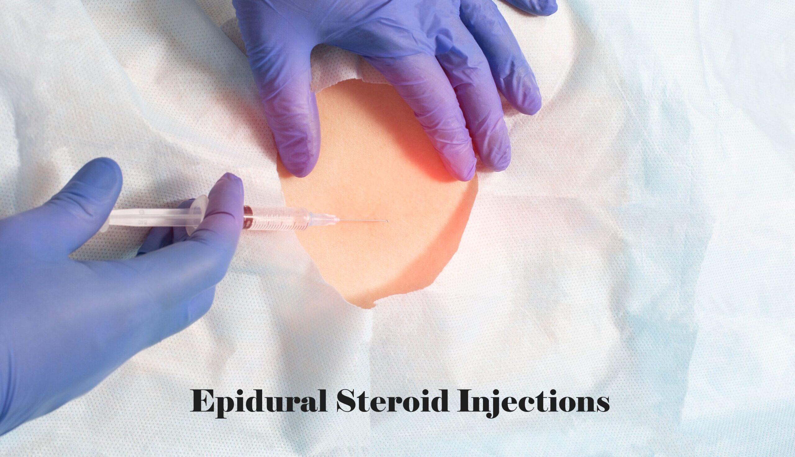 The Importance of Epidural Steroid Injections After a Colorado Car Accident