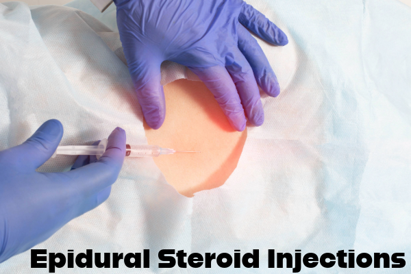 The Importance of Epidural Steroid Injections After a Colorado Car Accident